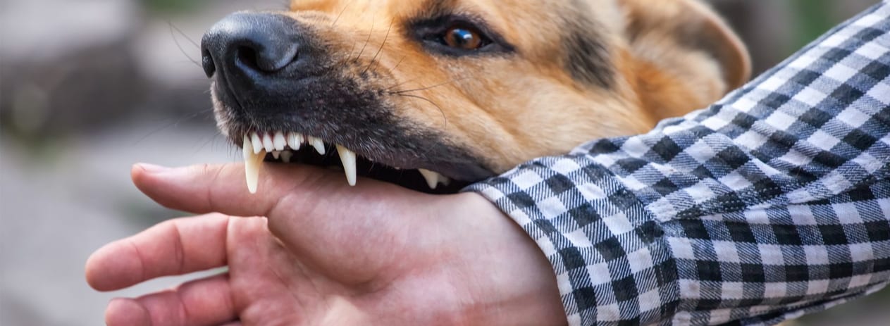 Dog Bites | Ross Law - Denton TX Attorney